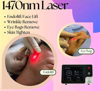 Aplikácie 1470nm 2,5W vláknovej laserovej diódy
